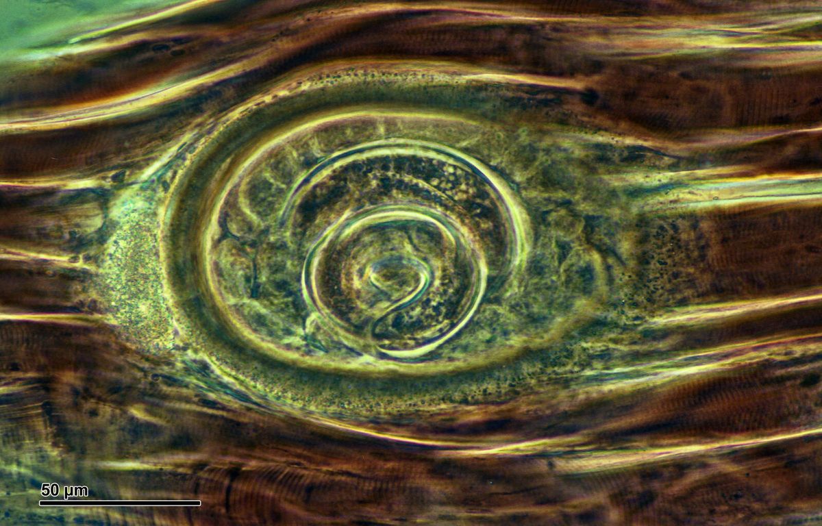Mikroskopische Aufnahme einer eingekapselten Trichinella-Larve in quergestreifter Muskulatur, mit Maßstab 50 Mikrometer