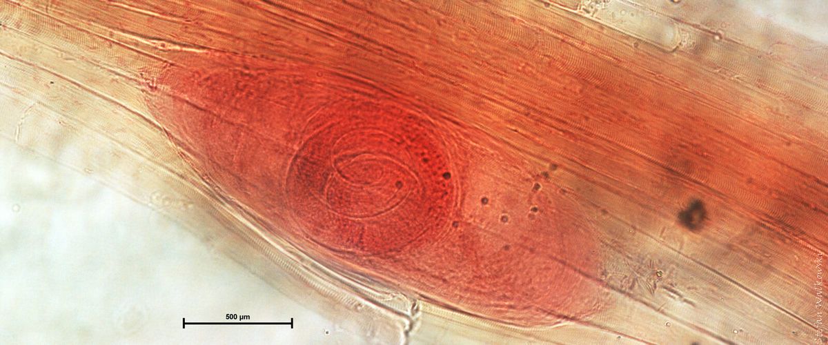 Mikroskopische Aufnahme eingekapselter Trichinella-Larven in Muskelgewebe